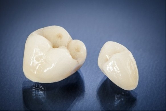 Two sample metal free dental crowns