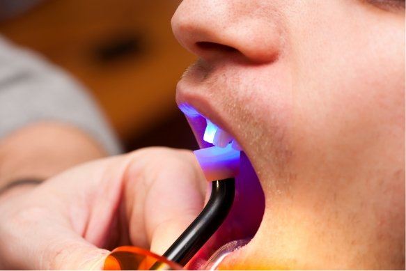 Dental patient receiving cosmetic dental bonding