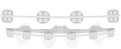 Animated row of teeth with traditional braces
