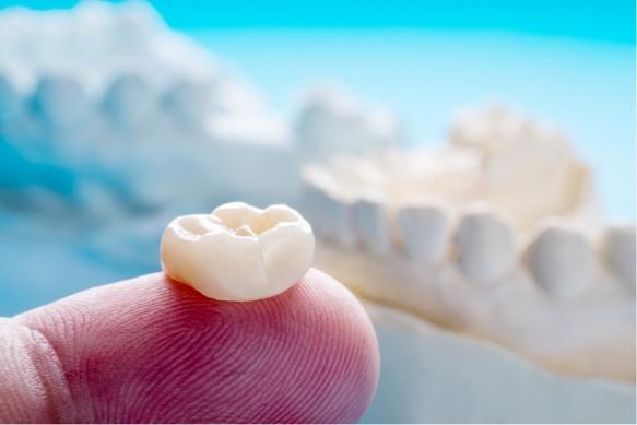 Dental crown on fingertip